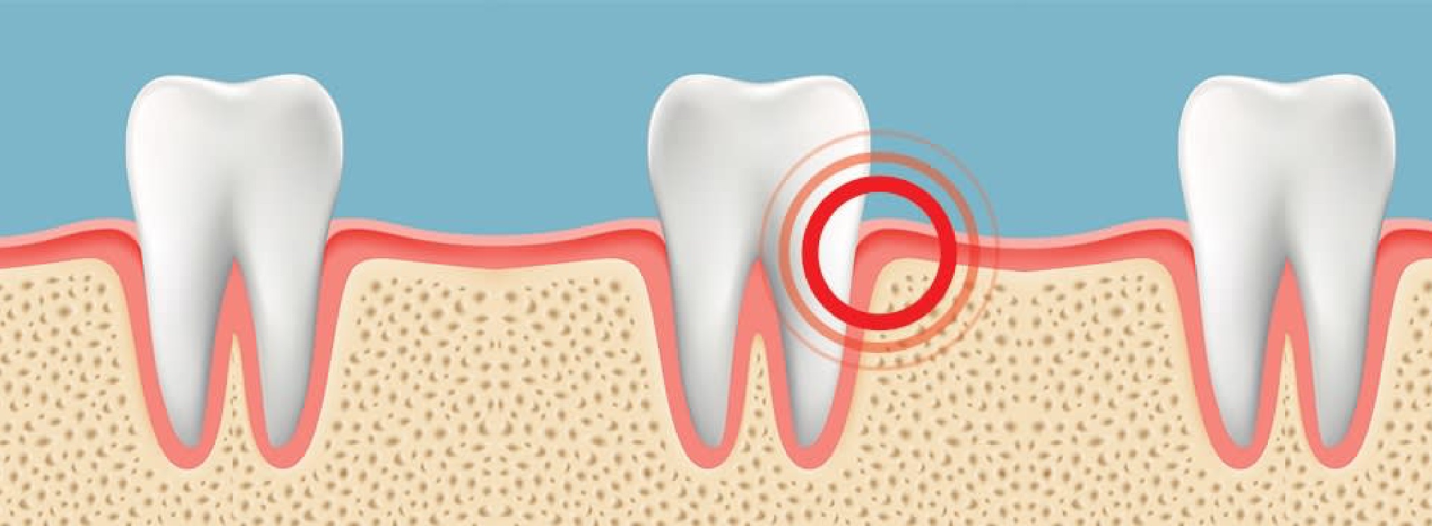 What Are The Basic Gum Pain Causes?
