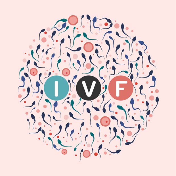 ivf